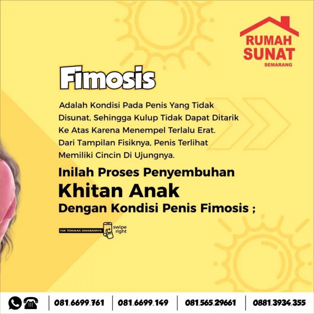 Solusi Terbaik untuk Mengatasi Fimosis pada Anak: Sunat Fimosis di Rumah Sunat Semarang yang Dilengkapi dengan Alat Medis Modern dan Terbaik